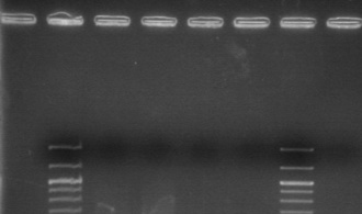 Multiplex PCR mise au point pour détecter la bactérie du dépérissement de l'oignon.