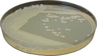 Bactériologie : tout savoir sur les bactéries