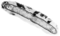 Cellule de Xanthomonas sp. pv. mangiferaeindicae en division. Une cellule fait environ 2µm sur 0,5µm. Photographie au microscope electronique.