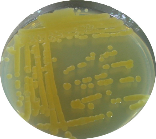 Colonie de bactéries sur milieu nutritif gélosé.