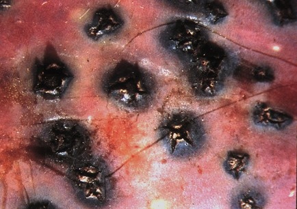 Gros plan sur des symptômes sur fruits.